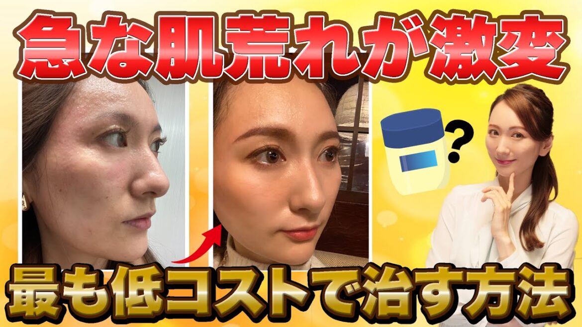 【1週間で激変】急な肌荒れを最速で治す方法【コスパ最強】