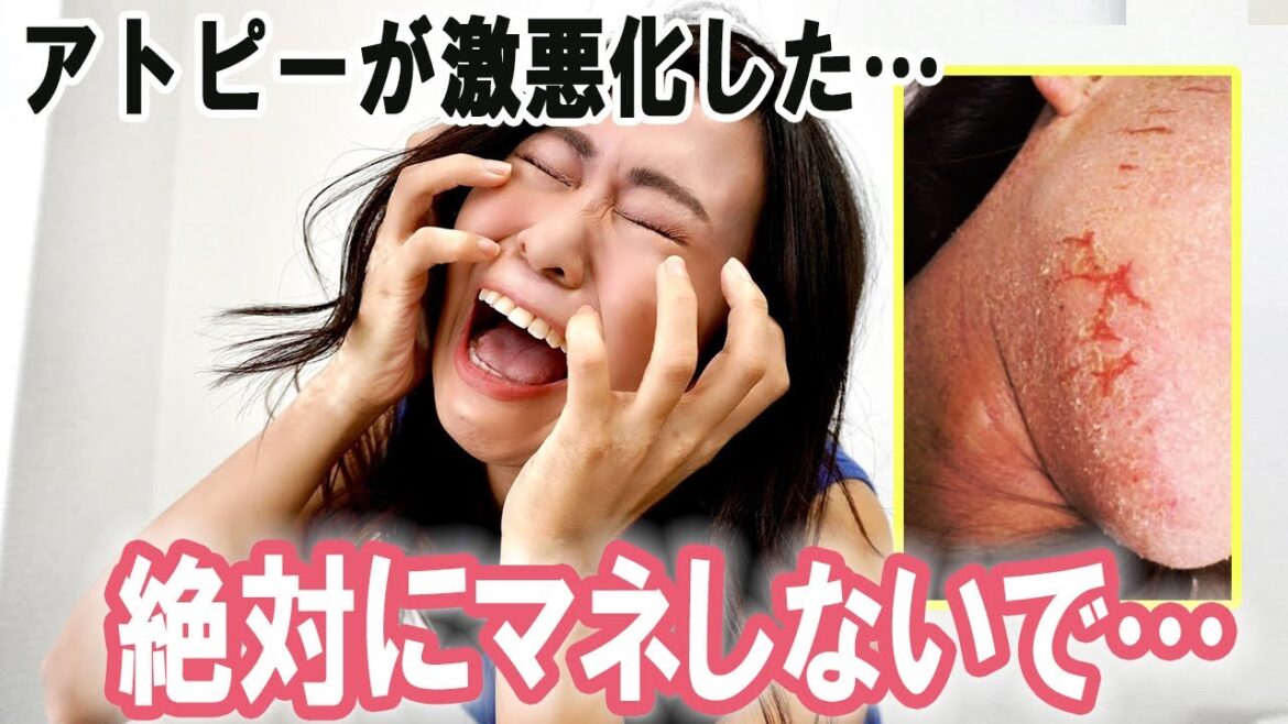 【悲報】アトピー激悪化!実は最悪のスキンケア。後悔する前に見て【無料プレゼント付】 【悲報】アトピー激悪化!実は最悪のスキンケア。後悔する前に見て【無料プレゼント付】