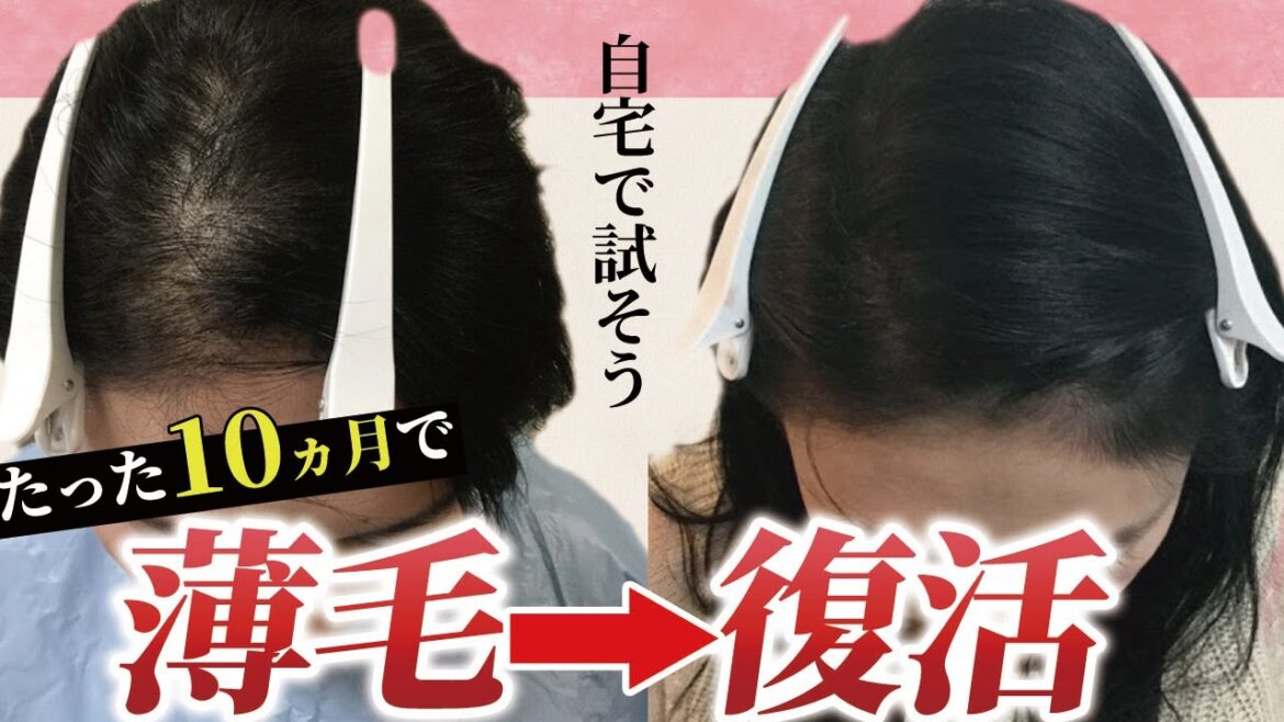 【薄毛も改善】正しい知識が薄毛の悩みを改善。自宅で出来る薄毛対策