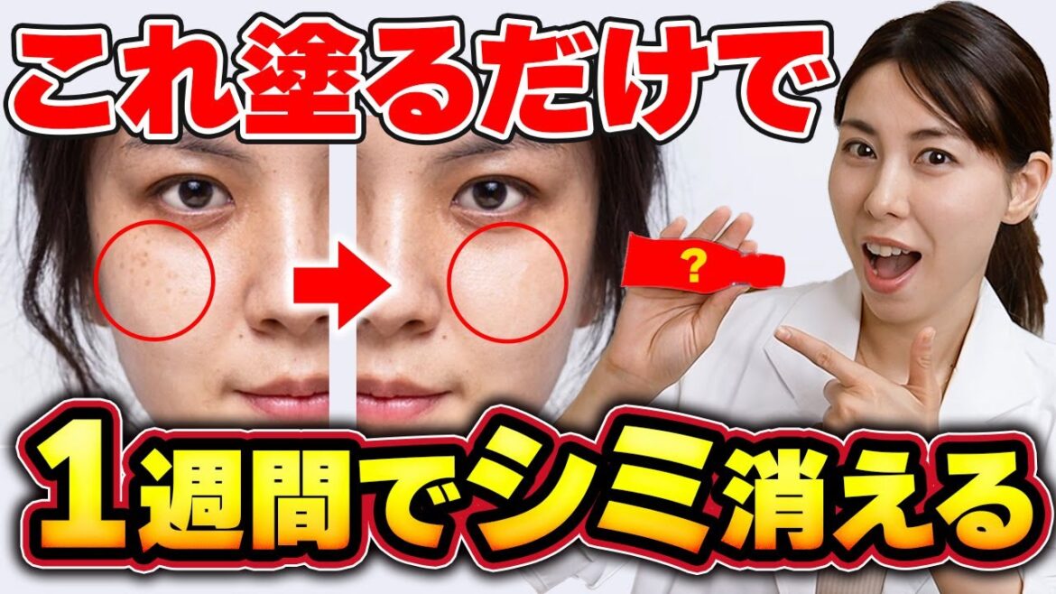 【塗るだけでシミ消える】たった数千円のクリームで1週間でシミを消す方法! エステのシミ取り・市販のシミ化粧品不要【シミ消す方法】 【塗るだけでシミ消える】たった数千円のクリームで1週間でシミを消す方法! エステのシミ取り・市販のシミ化粧品不要【シミ消す方法】