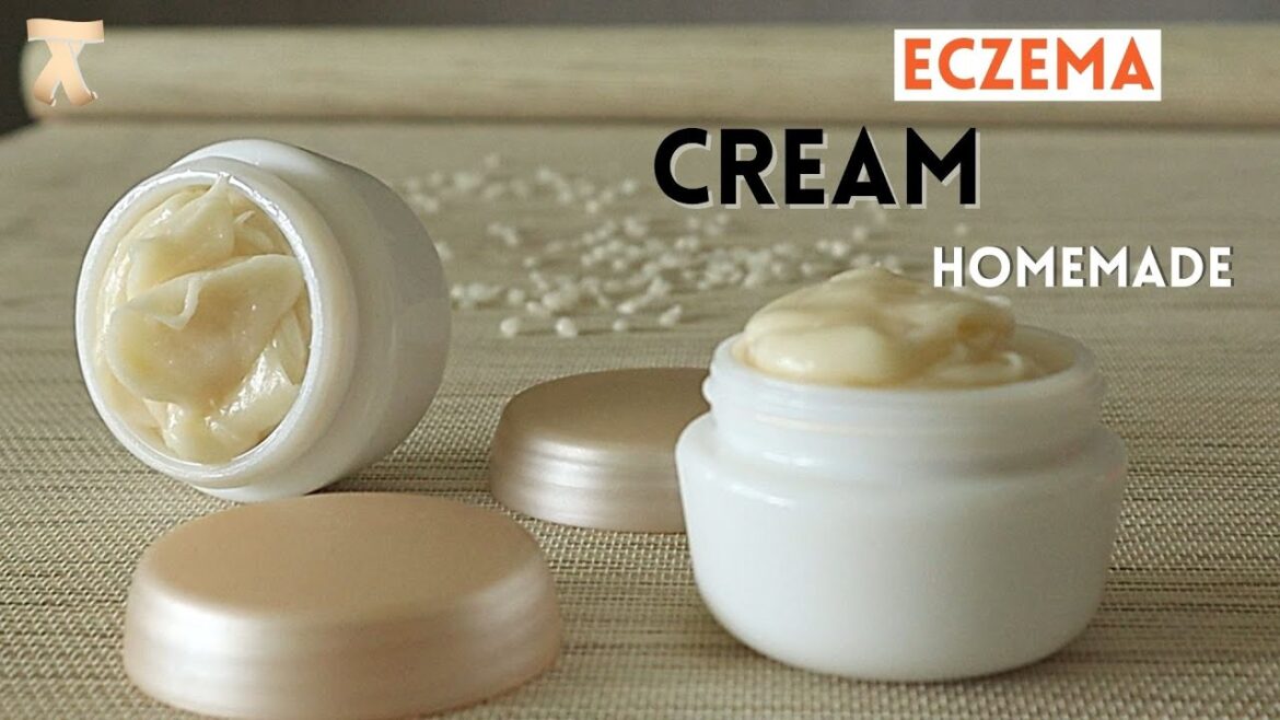 Homemade eczema cream recipe || Itchy Skin Relief Homemade eczema cream recipe || Itchy Skin Relief