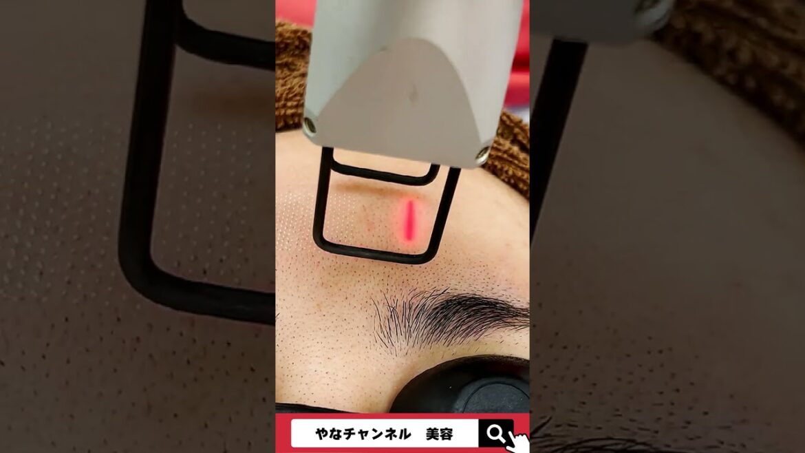【集合体恐怖症以外の方は見て！】肌に穴を開ける治療…？ #shorts