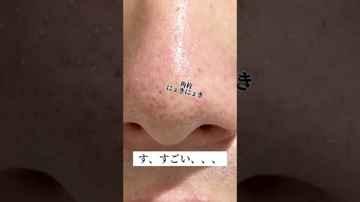 頑固毛穴本当に綺麗になるの？？