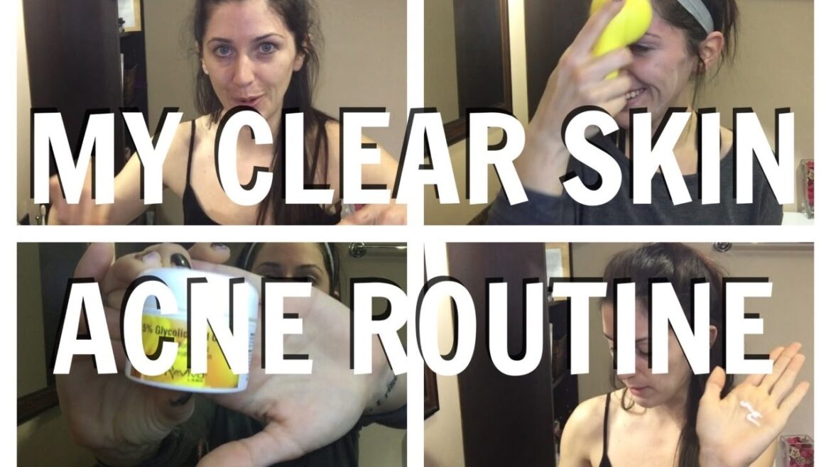 *BEST* ACNE SKINCARE ROUTINE FOR FLAWLESS SKIN | MORNING + NIGHT