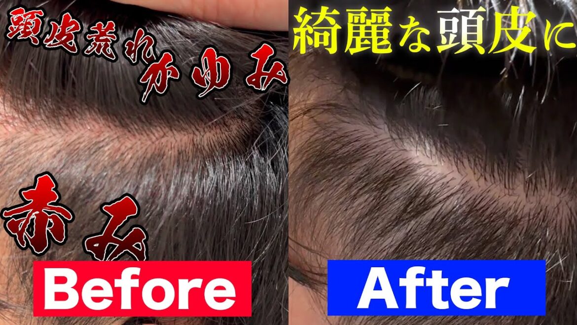 【スカルプ】頭皮ケアができるトリートメント知ってる!?結果出まくりでえげつねぇ!!【Aujua】 【スカルプ】頭皮ケアができるトリートメント知ってる!?結果出まくりでえげつねぇ!!【Aujua】