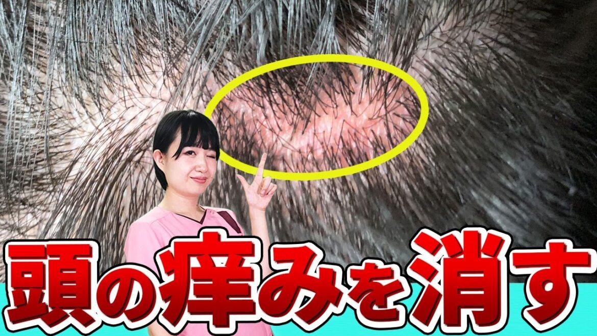 【これからの時期必見】頭皮湿疹が出たら掻く前に見てください