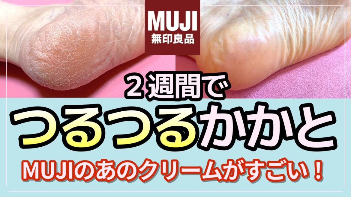 かかとケア 無印良品のクリームでカサカサがツルツルに！
