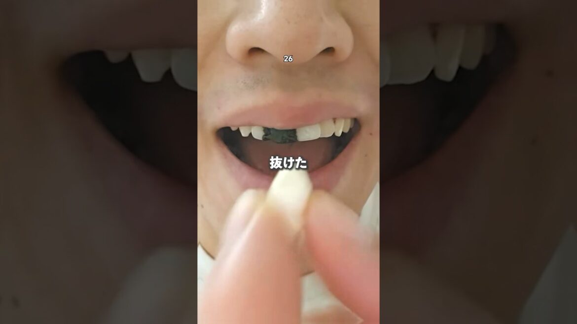 突然歯が抜けた時の対処方法は！？