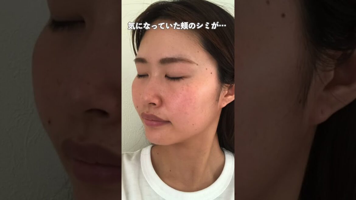 シミに悩むアラサーが2年間スキンケアを頑張った結果…#shorts