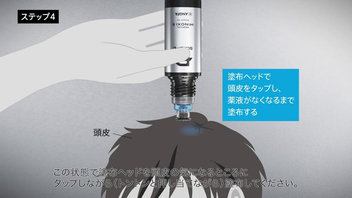 スカルプD  メディカルミノキ５ ［使い方］