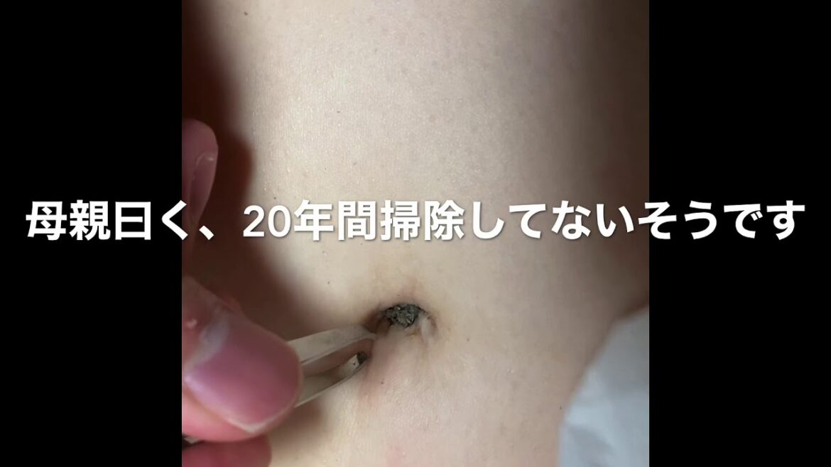 【驚愕！】20年間溜め込んだへそのゴマを取ってみた！