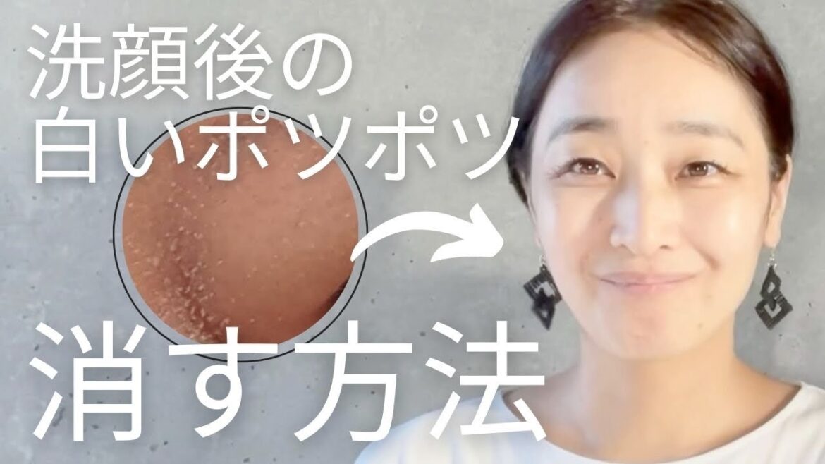 【美肌】白いポツポツの『正体』『原因』『なくす方法』解説！50歳セラピストの美肌のためのリアルケア！