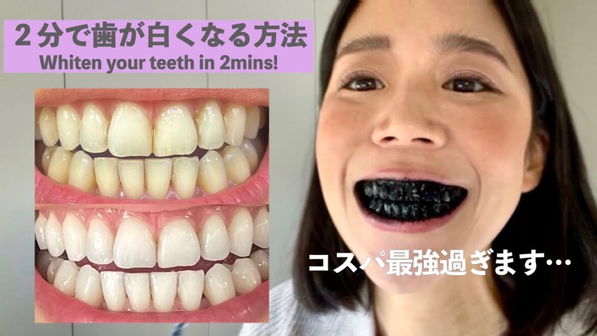 【1回150円】たった２分で歯が白くなります  ホワイトニング不要！