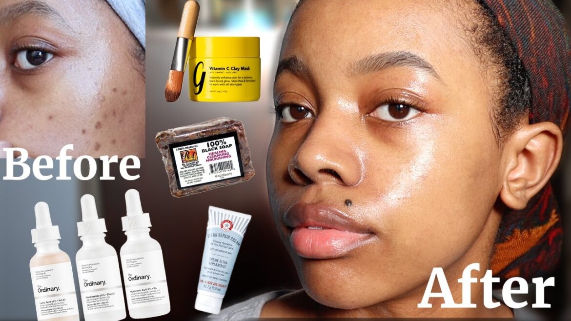 My Morning & Nighttime Skincare Routine | What I Use To Fade My Acne Scars