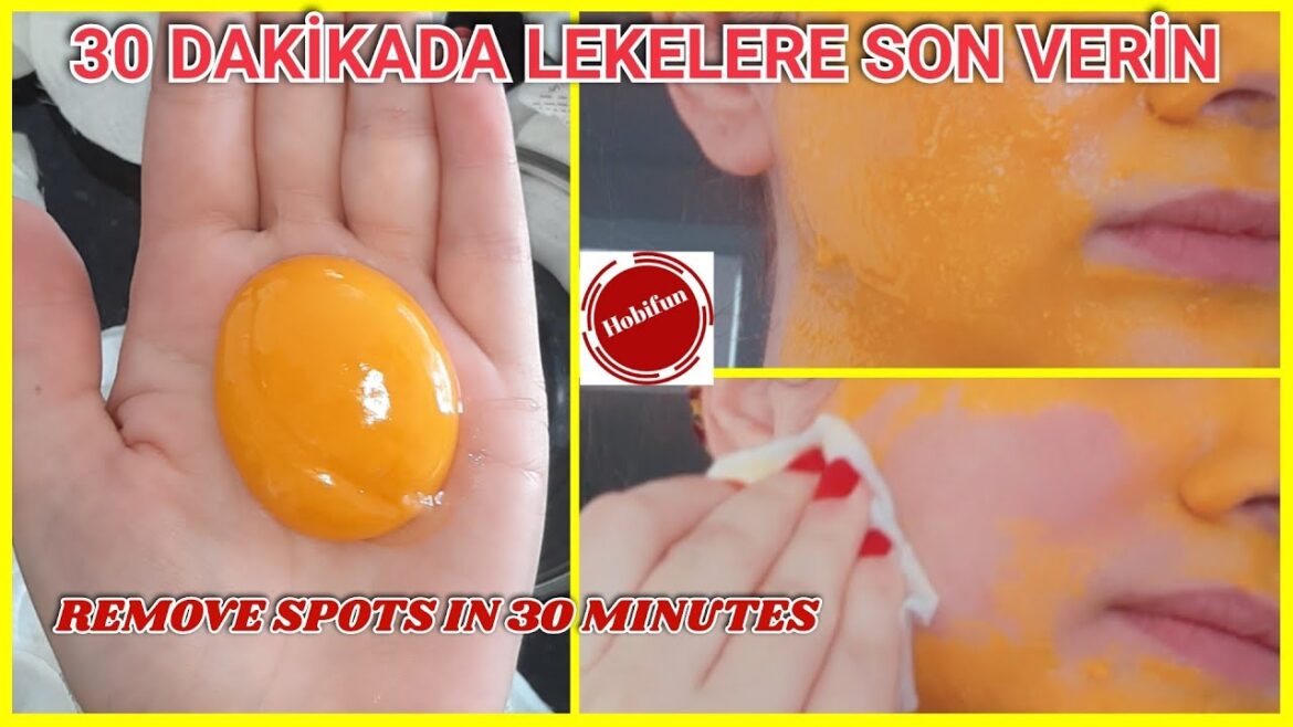 YUMURTA SARISI İLE 30 DAKİKADA LEKELERİ YOK ET ! CİLT BEYAZLATICI DOĞAL MASKE