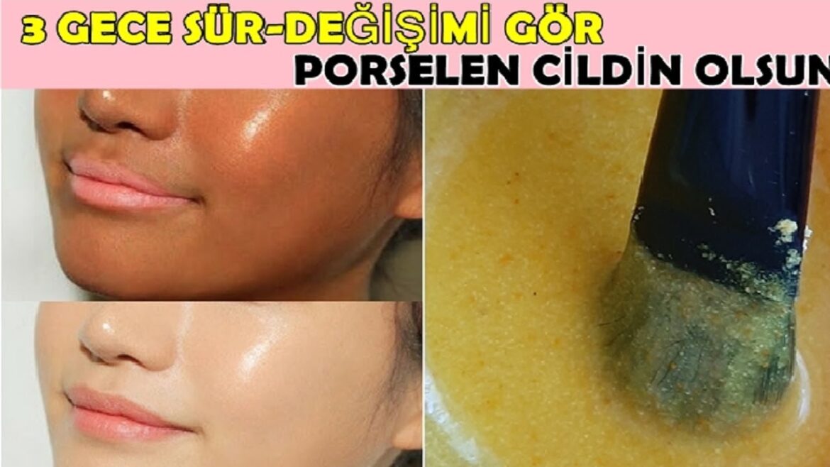 3 GECE BUNU UYGULA ,LEKELER GİTSİN ,BEYAZLA – ZERDEÇAL MASKESİ İLE PORSELEN CİLT 3 GECE BUNU UYGULA ,LEKELER GİTSİN ,BEYAZLA - ZERDEÇAL MASKESİ İLE PORSELEN CİLT