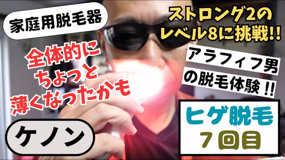 ケノンでヒゲともみあげ脱毛７回目の照射｜ストロング２のレベル８にチャレンジ！