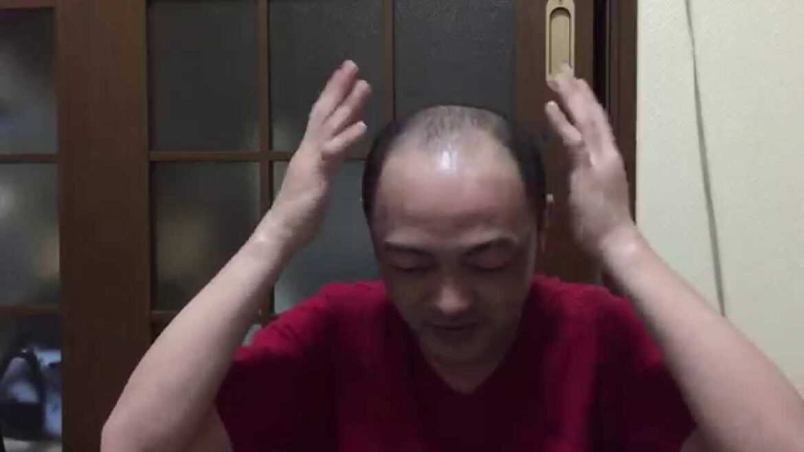 【実験】スカルプDはハゲでも効果があるのか⁉︎二週間目 Is there a effect of hair growth shampoo Scalp D?