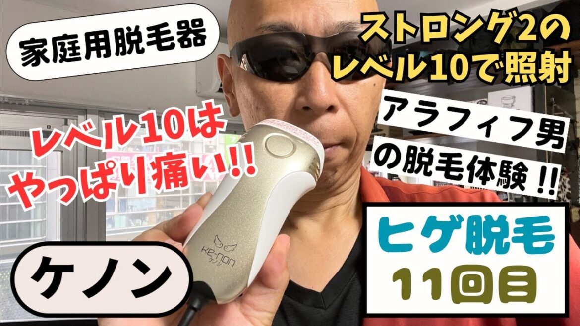 ケノンでヒゲとモミアゲの脱毛|10週間目の経過報告と11回目の照射 ケノンでヒゲとモミアゲの脱毛|10週間目の経過報告と11回目の照射