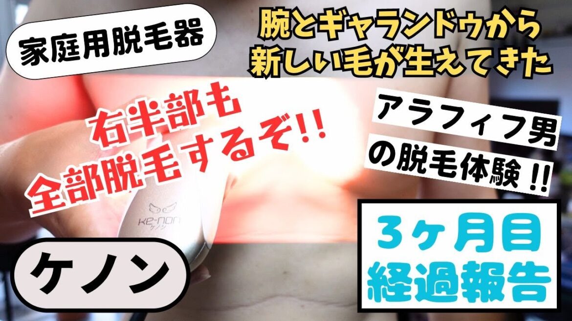 ケノンで脱毛して３ヶ月経過｜腕とギャランドゥ腹から新しい毛が生えてきました！