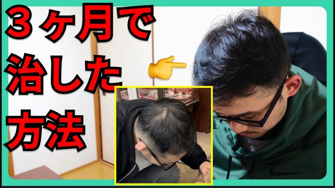 【３ヶ月】薄毛を確実に改善する方法とやっても効果がなかったこと