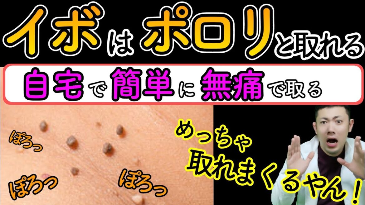 無痛で自宅で簡単にイボを取る方法