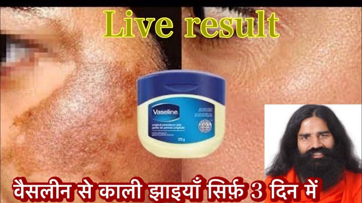 वैसलीन से काली झाइया कैसे हटाए सही तरीका | Vaseline Petroleum jelly For Face Whitening ||