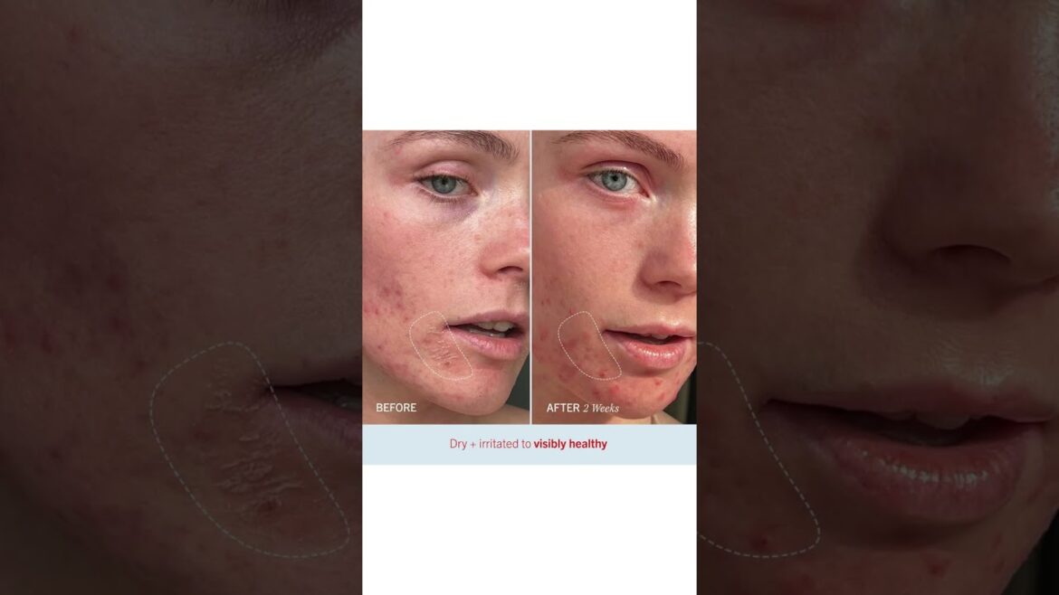 First Aid Beauty Ultra Repair Cream Test | Feuchtigkeitscreme für Gesicht & Körper #skincareroutine First Aid Beauty Ultra Repair Cream Test | Feuchtigkeitscreme für Gesicht & Körper #skincareroutine