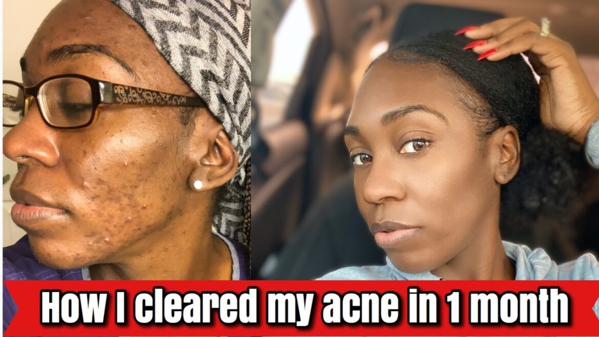 Dr Bronner pure-castile liquid soap | My morning skin routine | Nicolee Sutton