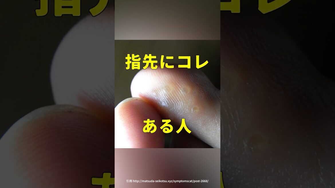 【指先の謎のブツブツの正体が判明】 #shorts #雑学 #汗疱 #湿疹 #痒み #肌荒れ #医者 #science