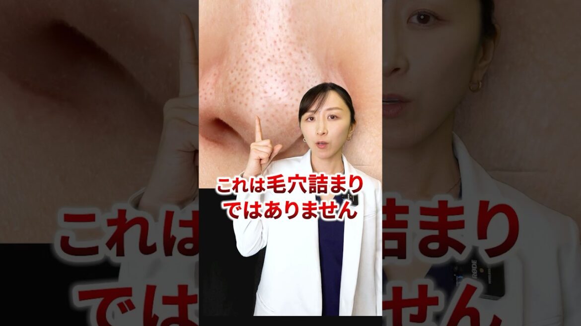 【毛穴】これは毛穴詰まりではありません。ケア方法を解説！