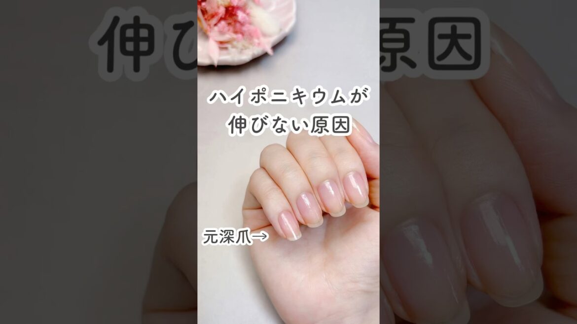 ハイポニキウムが伸びない原因 #nails #ネイルケア #セルフネイル #shorts
