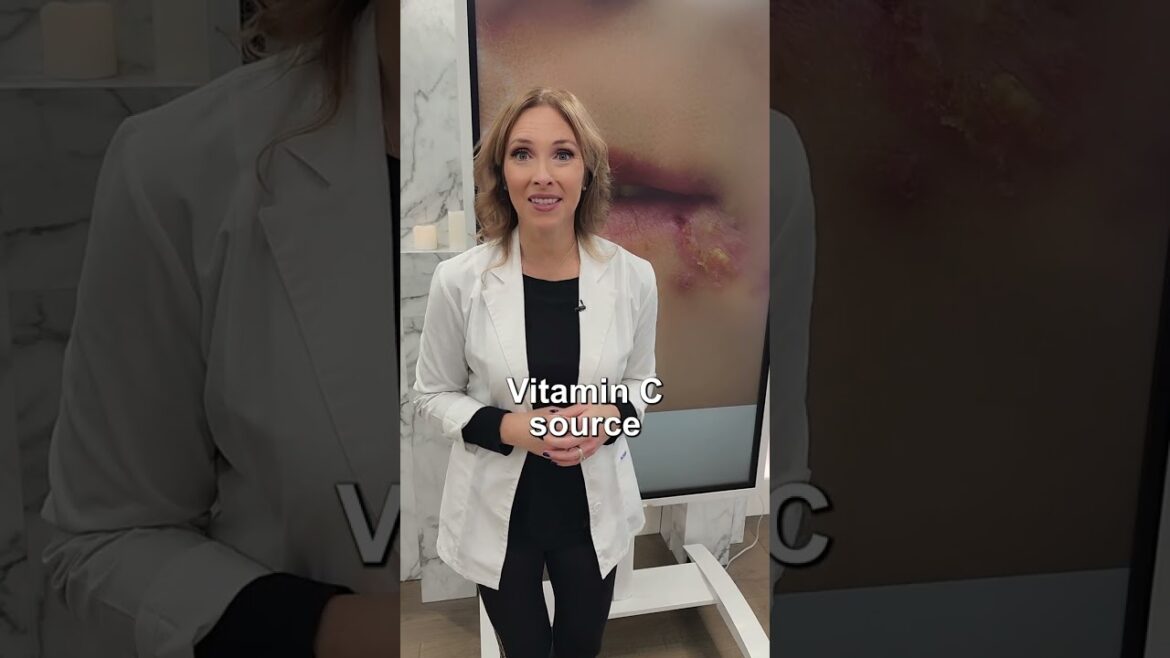 3 Tips for Cold Sores #shorts 3 Tips for Cold Sores #shorts