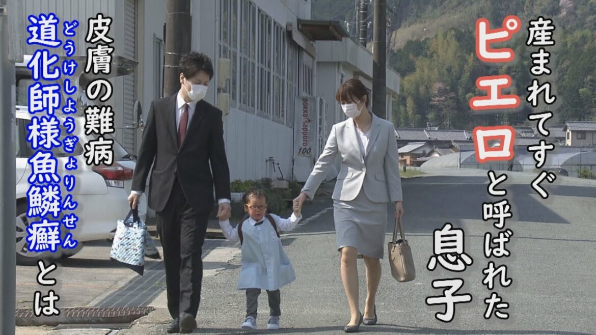 ピエロと呼ばれた息子　３０万人に１人の難病・道化師様魚鱗癬とは　定期配信型ドキュメンタリー　第１話