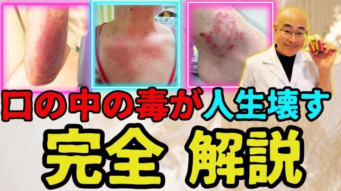 【完全版】健康を破壊する口の中の８つの毒。日本人の99％が知らない病気の原因を歯科医師が解説します。