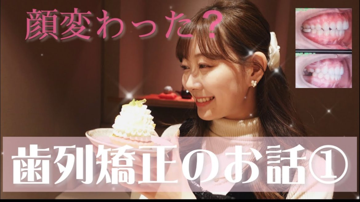 【渡辺美優紀】歯列矯正のお話①【みるきー】