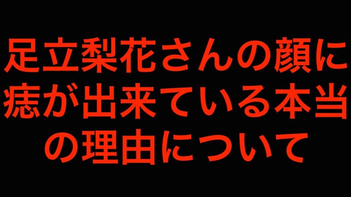 [真相]足立梨花さんの顔に痣が出来ている本当の理由について[masa46494]