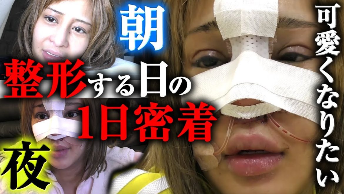 【密着】朝目覚めてから整形のダウンタイムで帰ってくる日の1日密着 【密着】朝目覚めてから整形のダウンタイムで帰ってくる日の1日密着