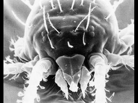 【閲覧注意】怖い!?アカツツガムシの画像あり!刺されたら死亡する可能性あり!気になる生息地は? 【閲覧注意】怖い!?アカツツガムシの画像あり!刺されたら死亡する可能性あり!気になる生息地は?