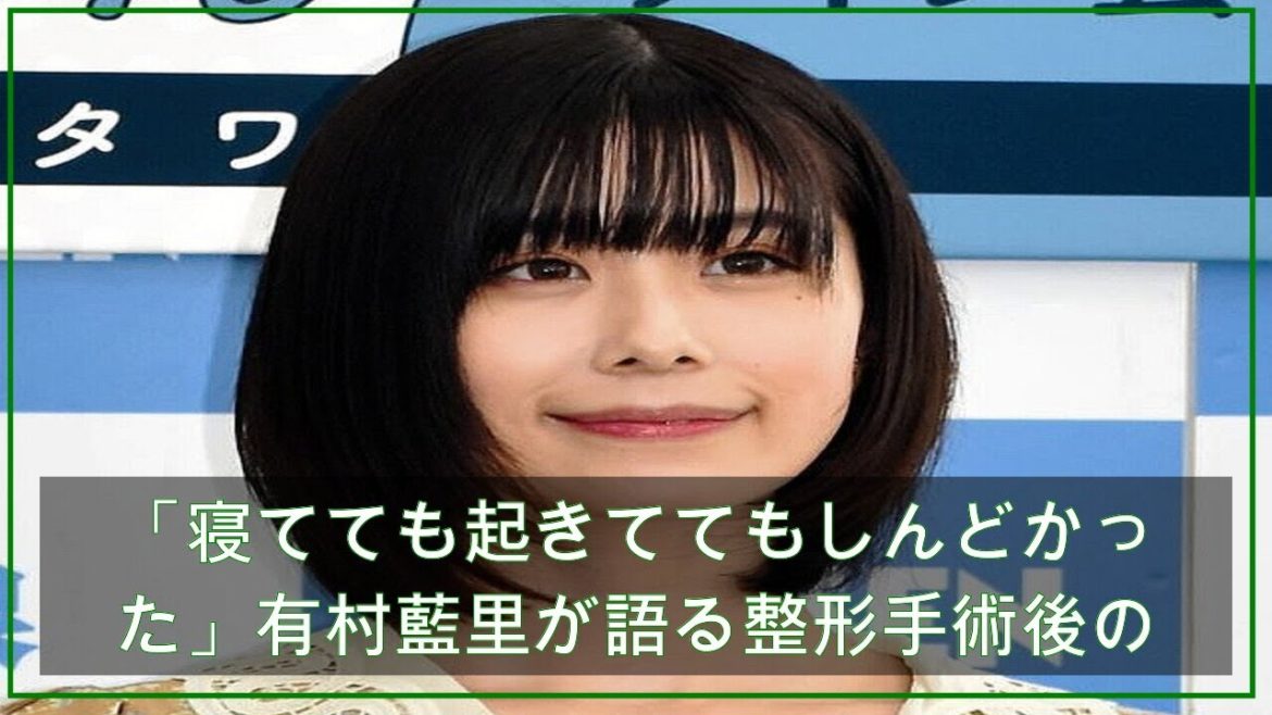 「寝てても起きててもしんどかった」有村藍里が語る整形手術後の痛み (2021年4月19日掲載) - ライブドアニュース