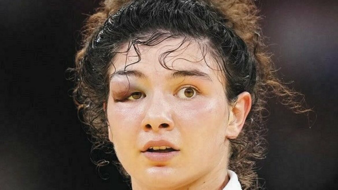 【動画】タイマゾワ選手 目を負傷の瞬間！【新井千鶴 金メダル 柔道女子70kg オリンピック 東京五輪】
