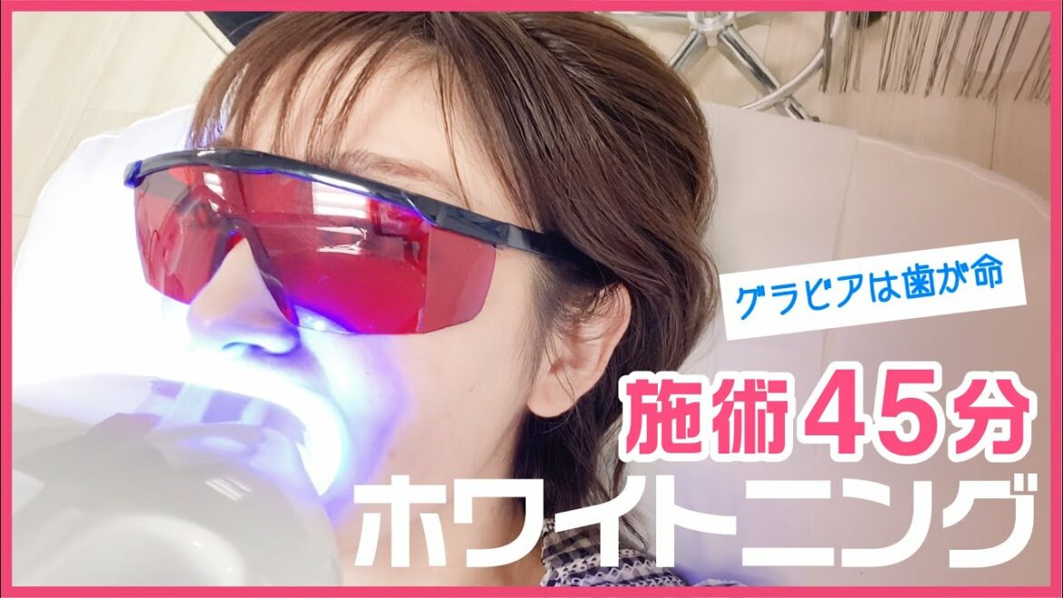 【グラビアは歯が命】１回４５分の施術で効果がわかるホワイトニングに行ってきました