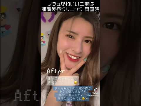 #shorts 北川景子似【せきさくら】さんが新里医師でQCW受けたってマ!? #shorts 北川景子似【せきさくら】さんが新里医師でQCW受けたってマ!?