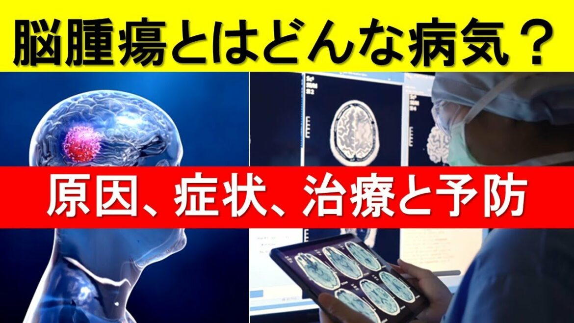 脳腫瘍の症状と原因、治療と予後について解説します。