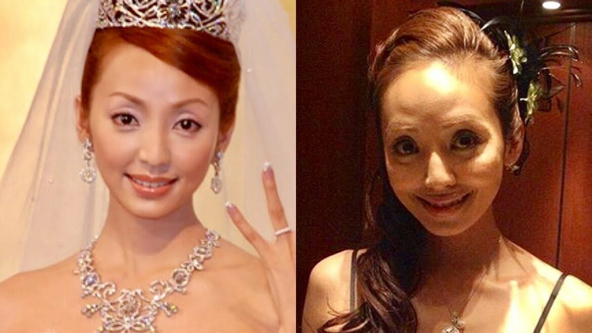 【比較画像】芸能人の整形失敗10選