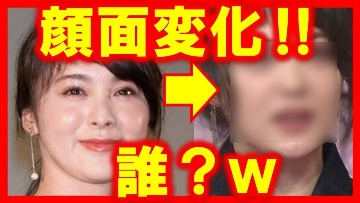 整形？高畑充希と貫地谷しほりの顔が変わりすぎ！ビフォーアフター！二重ラインが…鼻の形が…