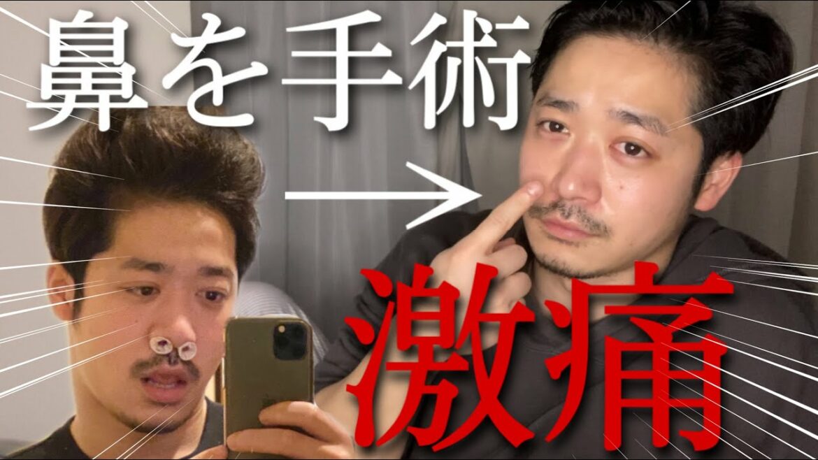 【鼻づまり改善】花粉症や副鼻腔炎に悩んで鼻を手術してきました。