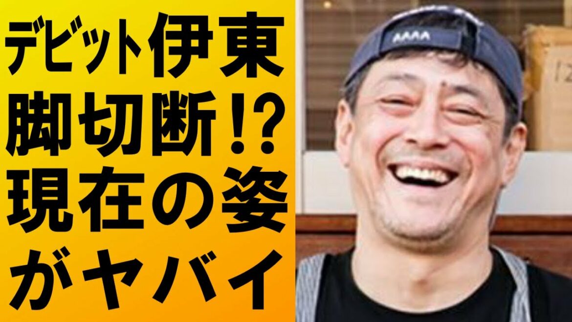 【衝撃】デビット伊東が足を切断⁉現在の姿に驚きを隠せない....
