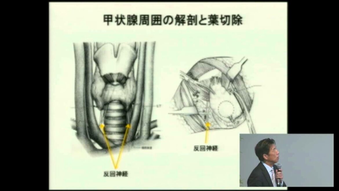 甲状腺がんの診断・治療と今後について 林 隆一