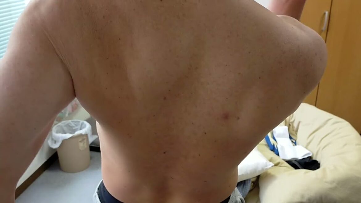 コロナウイルス感染前の背中